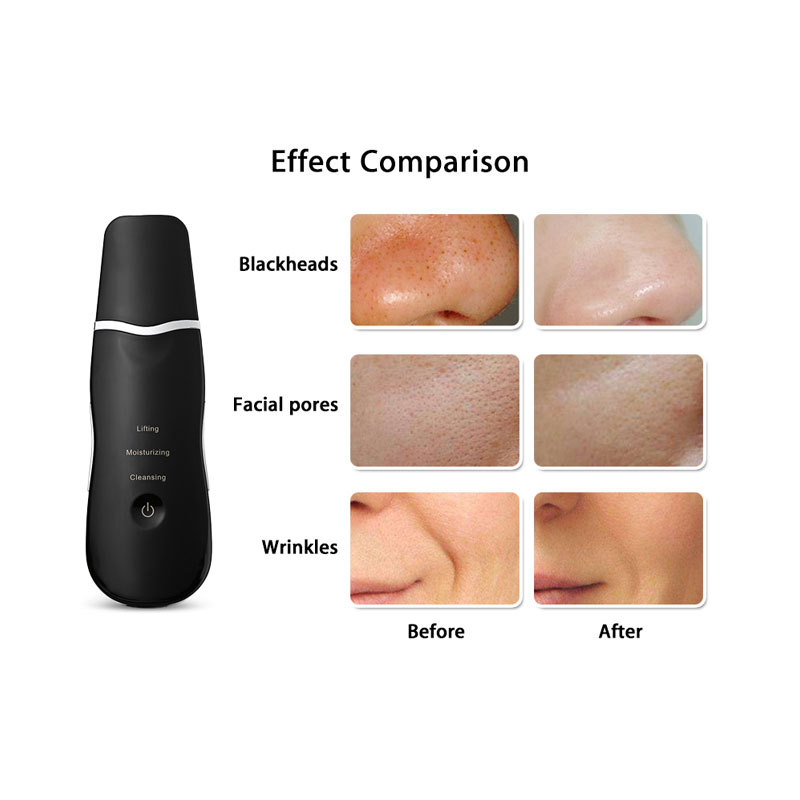 Équipement de beauté rechargeable, dissolvant de points noirs ultrasonique, nettoyant pour le visage, épurateur de peau